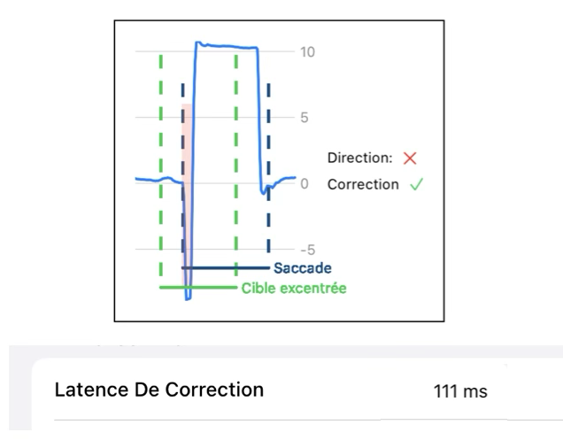 Exemple de réponse erronée avec correction : mesure de la latence de correction.