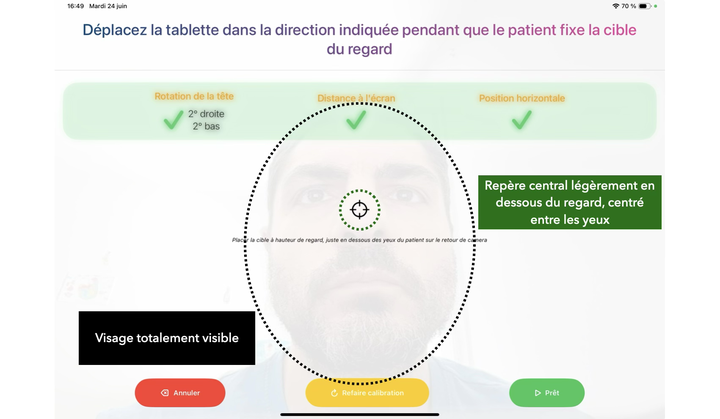 Contrôle du positionnement du patient : rotation de la tête, distance et centrage face à l'écran.